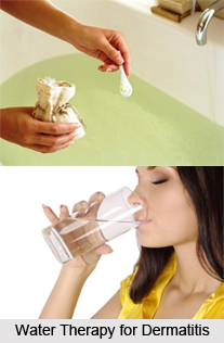 Natural Remedy for Dermatitis, Naturopathy