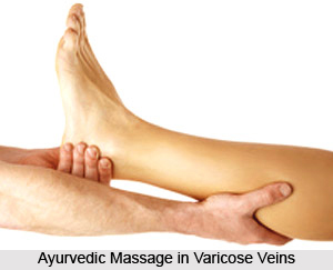 Ayurvedic Massage in Varicose Veins