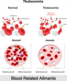 Blood Related Ailments, Naturopathy