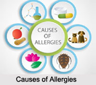 Causes of Allergies, Naturopathy