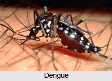 Dengue Fever or Dandak Jwara