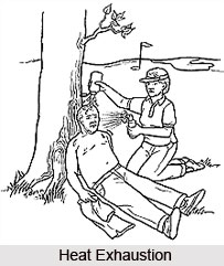 Heat Exhaustion and Heat Stroke or Aanshughata Jwara and Anshughata Sannipata