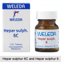 Homeopathy for Tonsillitis