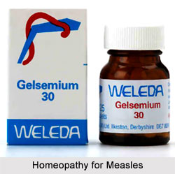Homeopathy for Measles