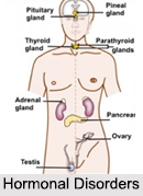 Hormonal Disorders, Naturopathy