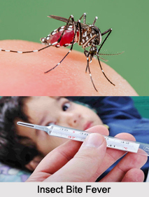 Insect Bite Fever, Fever