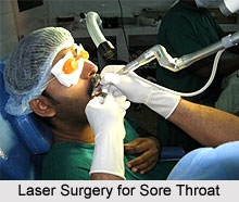 Laser Surgery for Sore Throat