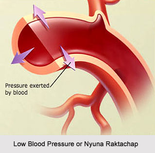 Low Blood Pressure or Nyuna Raktachap