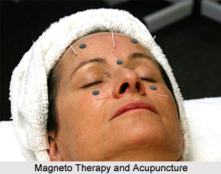 Magneto Therapy and Acupuncture