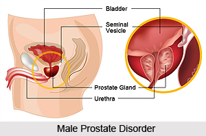Male Disorders, Naturopathy