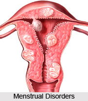 Menstrual Disorders