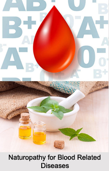 Naturopathy for Blood Related Diseases, Indian Naturopathy