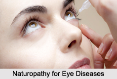 Naturopathy for Eye Diseases, Indian Naturopathy
