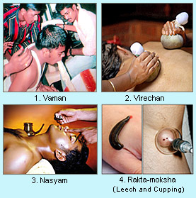 Panchwidh Chikitsha