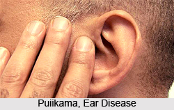 Puiikama, Ear Disease