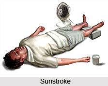Sunstroke