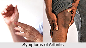Symptoms of Arthritis