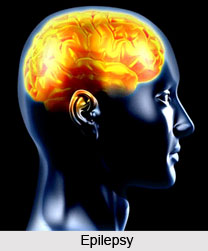 Symptoms of Epilepsy