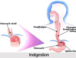 Symptoms of Indigestion
