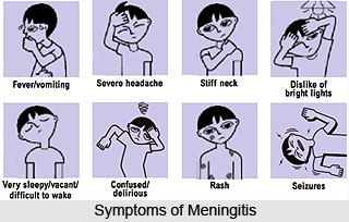 Symptoms of Meningitis