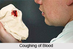 Symptoms of Pneumonia