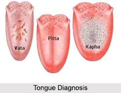 Tongue Diagnosis in Ayurveda