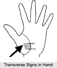 Transverse Signs in Hand, Palmistry