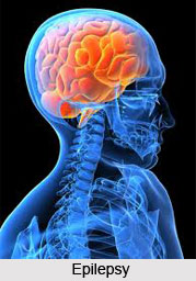 Treatment of Epilepsy