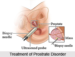 Treatment of Prostrate Disorder
