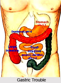 Types of Gastric Trouble