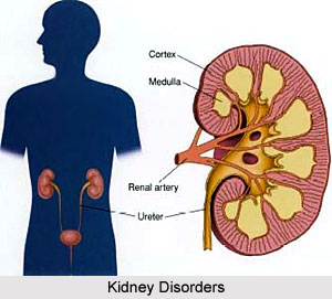 Types of Kidney Disorders