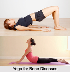 Yoga for Bone Diseases, Yoga