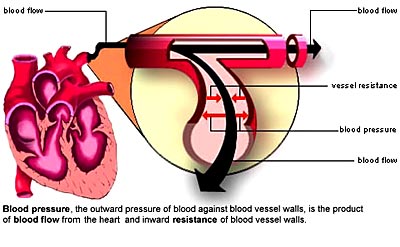 Causes Of High Blood Pressure